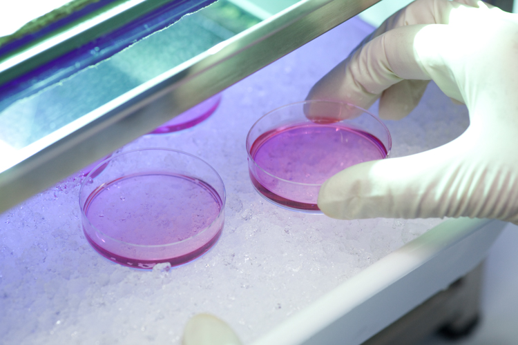 Hand nimmt Petrischale mit rosa Flüssigkeit